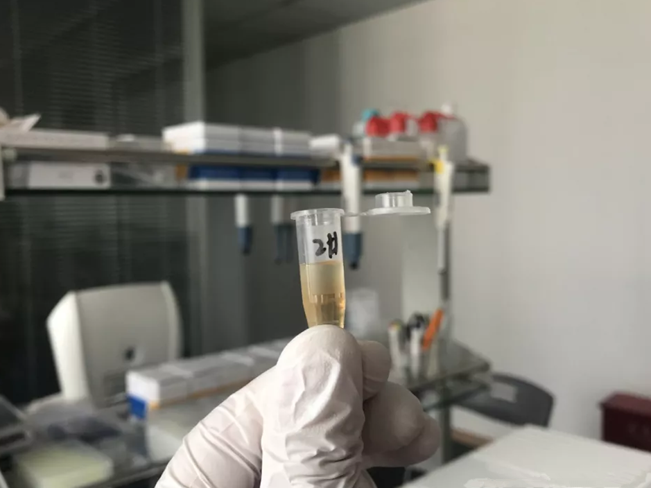 水煮花生含甲醛？實(shí)測多家燒烤店結(jié)果太可怕！